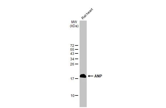 Rat tissue extract (50 μg) was separated by 15% SDS-PAGE, and the membrane was blotted with ANP antibody [HL2617] (GTX639071) diluted at 1:1000. The HRP-conjugated anti-rabbit IgG antibody (GTX213110-01) was used to detect the primary antibody.
