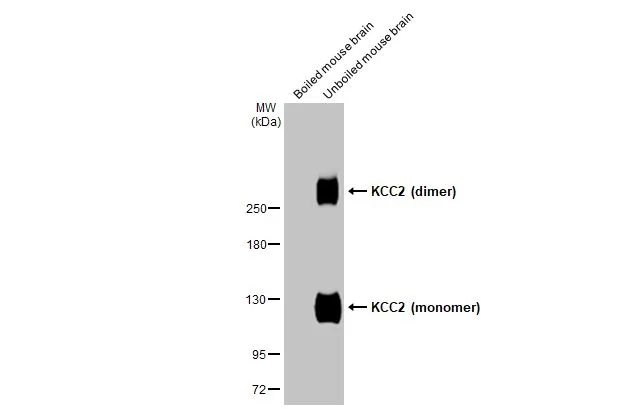 KCC2 antibody [HL2624]