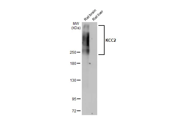 KCC2 antibody [HL2624]