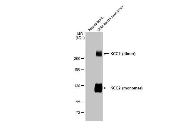 KCC2 antibody [HL2625]