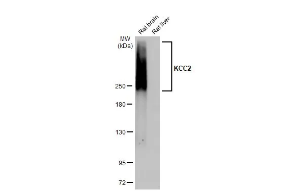 KCC2 antibody [HL2625]