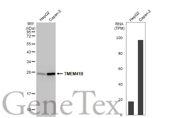 TMEM41B antibody [HL2628]