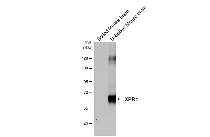 Anti-XPR1 antibody [HL2631] (GTX639087) | GeneTex