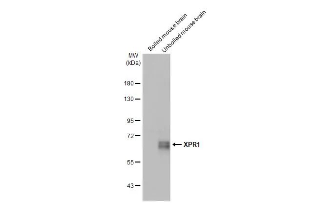 Boiled and unboiled mouse tissue extract (50 μg) were separated by 7.5% SDS-PAGE, and the membrane was blotted with XPR1 antibody [HL2632] (GTX639088) diluted at 1:1000. The HRP-conjugated anti-rabbit IgG antibody (GTX213110-01) was used to detect the primary antibody, and the signal was developed with Trident ECL plus-Enhanced.