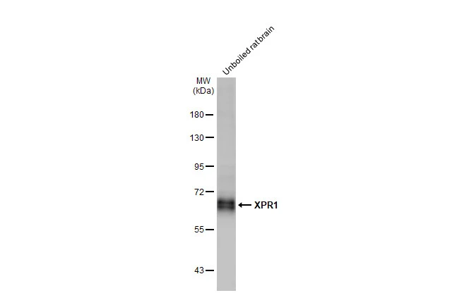 Unboiled rat tissue extract (50 μg) was separated by 7.5% SDS-PAGE, and the membrane was blotted with XPR1 antibody [HL2632] (GTX639088) diluted at 1:1000. The HRP-conjugated anti-rabbit IgG antibody (GTX213110-01) was used to detect the primary antibody, and the signal was developed with Trident ECL plus-Enhanced.