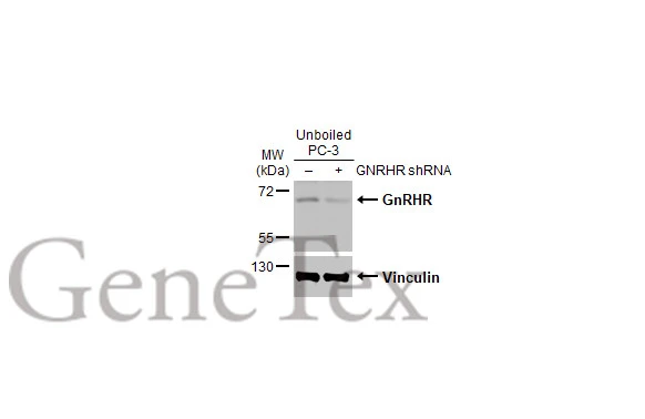 Non-transfected (–) and transfected (+) unboiled PC-3 whole cell extracts (30 μg) were separated by 10% SDS-PAGE, and the membrane was blotted with GnRHR antibody [HL2638] (GTX639094) diluted at 1:1000. The HRP-conjugated anti-rabbit IgG antibody (GTX213110-01) was used to detect the primary antibody.