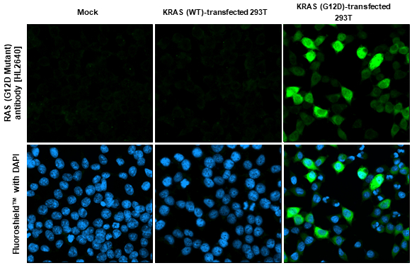 RAS (G12D Mutant) antibody [HL2640] detects RAS (G12D Mutant) protein by immunofluorescent analysis. Sample: Mock and transfected 293T cells were fixed in ice-cold MeOH for 5 min. Green: RAS (G12D Mutant) stained by RAS (G12D Mutant) antibody [HL2640] (GTX639096) diluted at 1:500. Blue: Fluoroshield with DAPI (GTX30920).