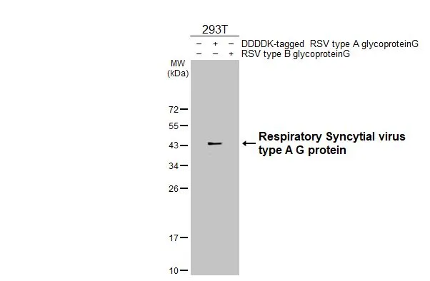 Non-transfected (–) and transfected (+) 293T whole cell extracts (30 μg) were separated by 12% SDS-PAGE, and the membrane was blotted with Respiratory Syncytial virus type A G protein antibody [HL2643] (GTX639099) diluted at 1:5000. The HRP-conjugated anti-rabbit IgG antibody (GTX213110-01) was used to detect the primary antibody, and the signal was developed with Trident ECL plus-Enhanced.