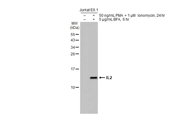 Untreated (–) and treated (+) Jurkat E6.1 whole cell extracts (30 μg) were separated by 15% SDS-PAGE, and the membrane was blotted with IL2 antibody [HL2645] (GTX639104) diluted at 1:1000. The HRP-conjugated anti-rabbit IgG antibody (GTX213110-01) was used to detect the primary antibody, and the signal was developed with Trident ECL plus-Enhanced.