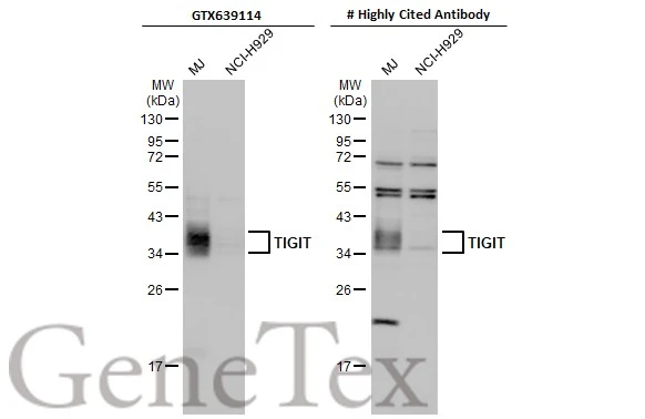 Various whole cell extracts (30 μg) were separated by 12% SDS-PAGE, and the membranes were blotted with TIGIT antibody [HL2655] (GTX639114) diluted at 1:1000 and competitor's antibody (Highly Cited Antibody) diluted at 1:1000. The HRP-conjugated anti-rabbit IgG antibody (GTX213110-01) was used to detect the primary antibody. *The competitor is not affiliated with GeneTex and does not endorse this product.