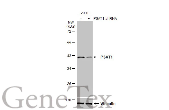 Non-transfected (–) and transfected (+) 293T whole cell extracts (30 μg) were separated by 10% SDS-PAGE, and the membrane was blotted with PSAT1 antibody [HL2663] (GTX639327) diluted at 1:3000. The HRP-conjugated anti-rabbit IgG antibody (GTX213110-01) was used to detect the primary antibody.