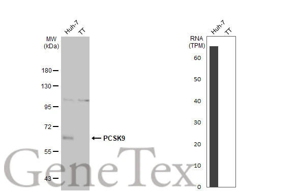PCSK9 antibody [HL2666]