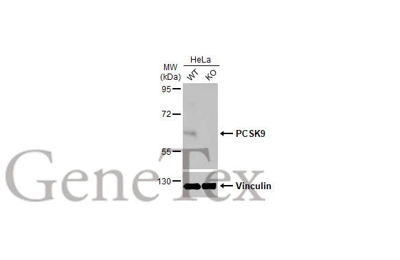 PCSK9 antibody [HL2666]