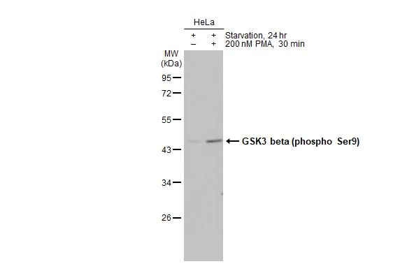 Untreated (–) and treated (+) HeLa whole cell extracts (30 μg) were separated by 10% SDS-PAGE, and the membrane was blotted with GSK3 beta (phospho Ser9) antibody [HL2671] (GTX639335) diluted at 1:1000. The HRP-conjugated anti-rabbit IgG antibody (GTX213110-01) was used to detect the primary antibody.