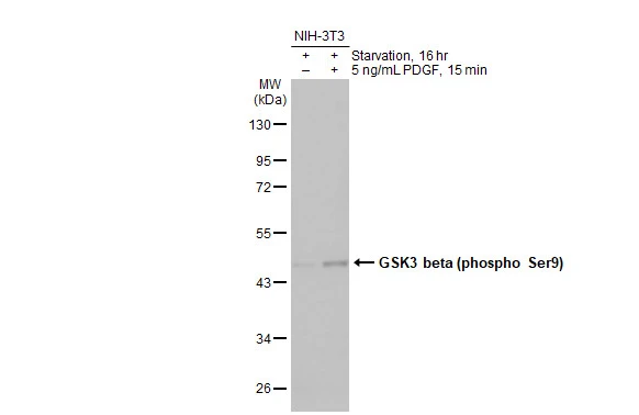Untreated (–) and treated (+) NIH-3T3 whole cell extracts (30 μg) were separated by 10% SDS-PAGE, and the membrane was blotted with GSK3 beta (phospho Ser9) antibody [HL2671] (GTX639335) diluted at 1:1000. The HRP-conjugated anti-rabbit IgG antibody (GTX213110-01) was used to detect the primary antibody, and the signal was developed with Trident ECL plus-Enhanced.