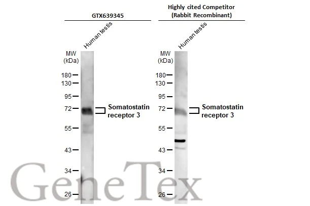 Human tissue extract (30 μg) was separated by 10% SDS-PAGE, and the membranes were blotted with Somatostatin receptor 3 antibody [HL2681] (GTX639345) diluted at 1:1000 and competitor's antibody (competitor) diluted at 1:1000. The HRP-conjugated anti-rabbit IgG antibody (GTX213110-01) was used to detect the primary antibody, and the signal was developed with Trident femto Western HRP Substrate. *The competitor is not affiliated with GeneTex and does not endorse this product.