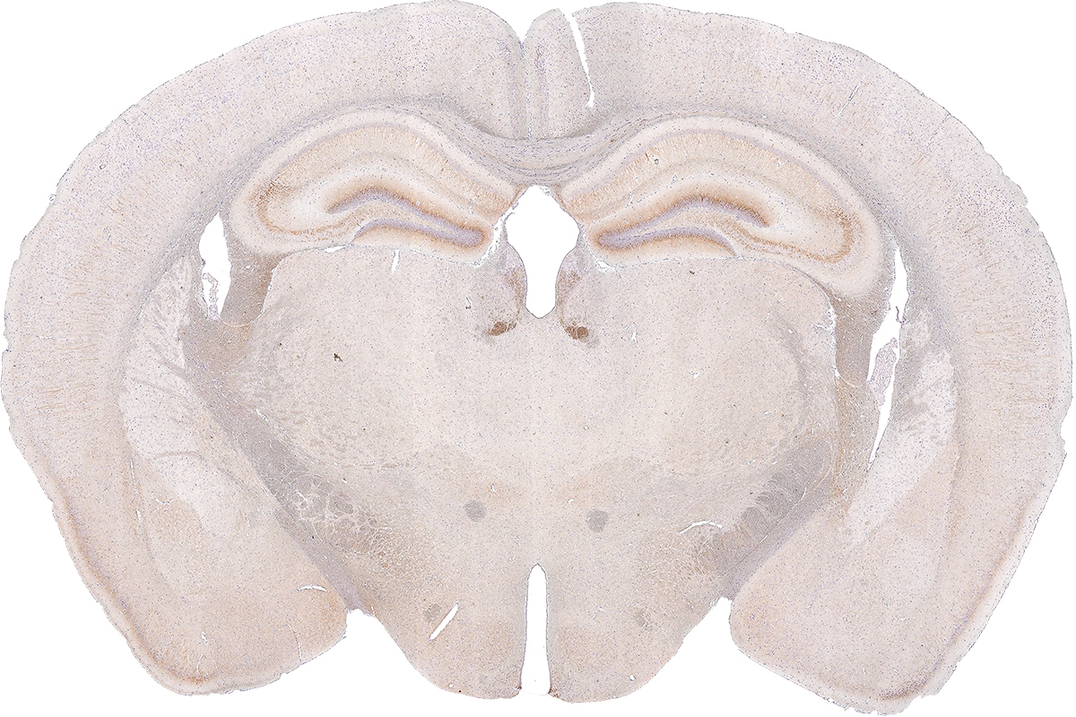 Somatostatin receptor 3 antibody [HL2681] detects Somatostatin receptor 3 protein by immunohistochemical analysis. Sample: Paraffin-embedded mouse brain. Somatostatin receptor 3 stained by Somatostatin receptor 3 antibody [HL2681] (GTX639345) diluted at 1:1200. Antigen Retrieval: Citrate buffer, pH 6.0, 15 min