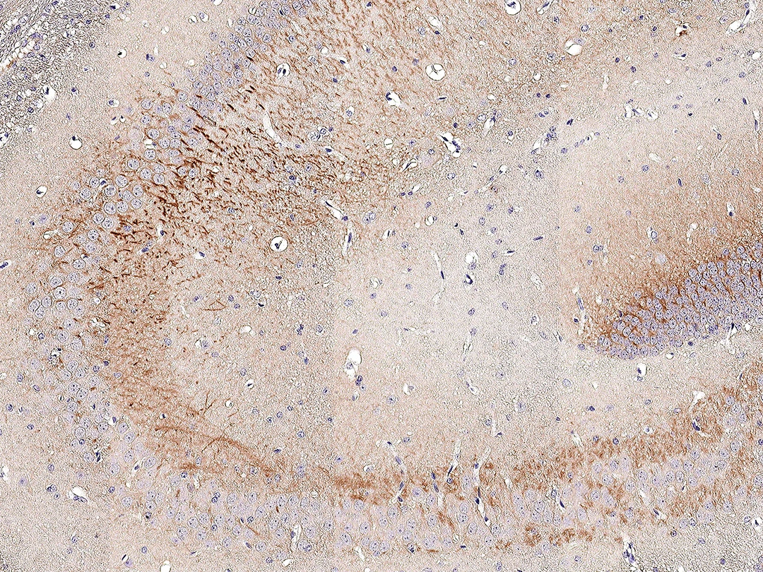 Somatostatin receptor 3 antibody [HL2681] detects Somatostatin receptor 3 protein by immunohistochemical analysis. Sample: Paraffin-embedded mouse hippocampus. Somatostatin receptor 3 stained by Somatostatin receptor 3 antibody [HL2681] (GTX639345) diluted at 1:1200. Antigen Retrieval: Citrate buffer, pH 6.0, 15 min