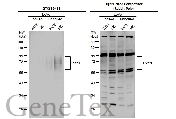 Boiled and unboiled LoVo whole cell and membrane extracts (30 μg) were separated by 10% SDS-PAGE, and the membranes were blotted with P2Y1 antibody [HL2702] (GTX639453) diluted at 1:1000 and competitor's antibody (competitor) diluted at 1:1000. The HRP-conjugated anti-rabbit IgG antibody (GTX213110-01) was used to detect the primary antibody, and the signal was developed with Trident ECL plus-Enhanced. *The competitor is not affiliated with GeneTex and does not endorse this product.