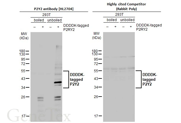 Non-transfected (–) and transfected (+) boiled and unboiled 293T whole cell extracts (30 μg) were separated by 10% SDS-PAGE, and the membranes were blotted with P2Y2 antibody [HL2704] (GTX639458) diluted at 1:5000 and competitor's antibody (competitor) diluted at 1:5000. The HRP-conjugated anti-rabbit IgG antibody (GTX213110-01) was used to detect the primary antibody. *The competitor is not affiliated with GeneTex and does not endorse this product.