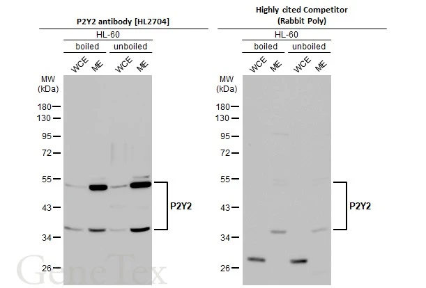Anti-P2Y2 antibody [HL2704] (GTX639458) | GeneTex