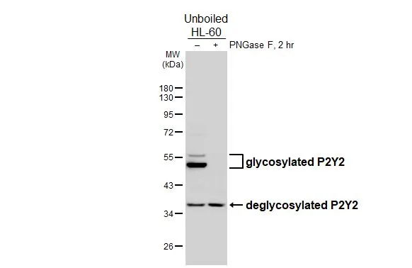 Untreated (–) and treated (+) unboiled HL-60 whole cell extracts (30 μg) were separated by 10% SDS-PAGE, and the membrane was blotted with P2Y2 antibody [HL2704] (GTX639458) diluted at 1:500. The HRP-conjugated anti-rabbit IgG antibody (GTX213110-01) was used to detect the primary antibody.