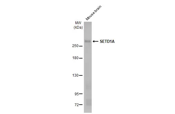 Mouse tissue extract (50 μg) was separated by 5% SDS-PAGE, and the membrane was blotted with SETD1A antibody [HL2705] (GTX639459) diluted at 1:1000. The HRP-conjugated anti-rabbit IgG antibody (GTX213110-01) was used to detect the primary antibody, and the signal was developed with Trident femto Western HRP Substrate.