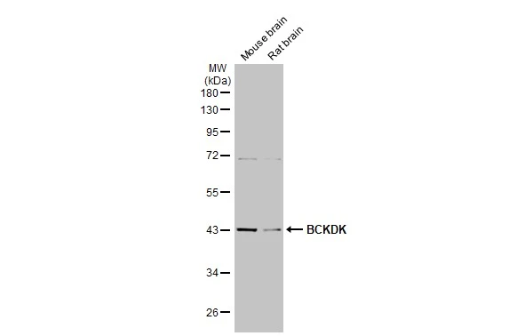 Various tissue extracts (50 μg) were separated by 10% SDS-PAGE, and the membrane was blotted with BCKDK antibody [HL2710] (GTX639471) diluted at 1:1000. The HRP-conjugated anti-rabbit IgG antibody (GTX213110-01) was used to detect the primary antibody.