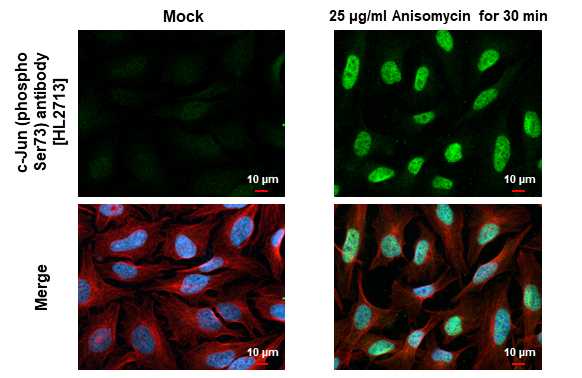 c-Jun (phospho Ser73) antibody [HL2713] detects c-Jun (phospho Ser73) protein at nucleus by immunofluorescent analysis. Sample: Mock and treated HeLa cells were fixed in 4% paraformaldehyde at RT for 15 min. Green: c-Jun (phospho Ser73) stained by c-Jun (phospho Ser73) antibody [HL2713] (GTX639474) diluted at 1:500. Red: alpha Tubulin, a cytoskeleton marker, stained by alpha Tubulin antibody [GT114] (GTX628802) diluted at 1:1000. Blue: Fluoroshield with DAPI (GTX30920).