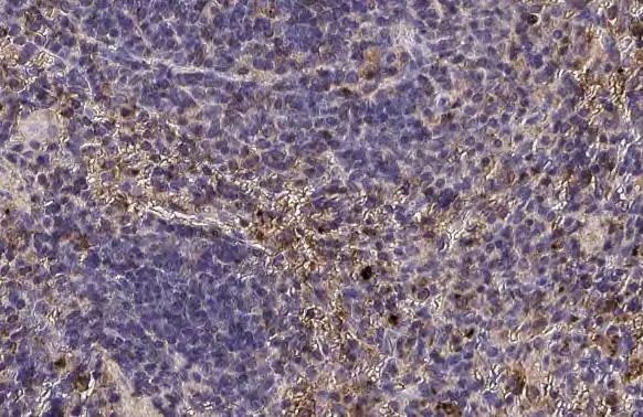 CTLA4 antibody [HL2732]