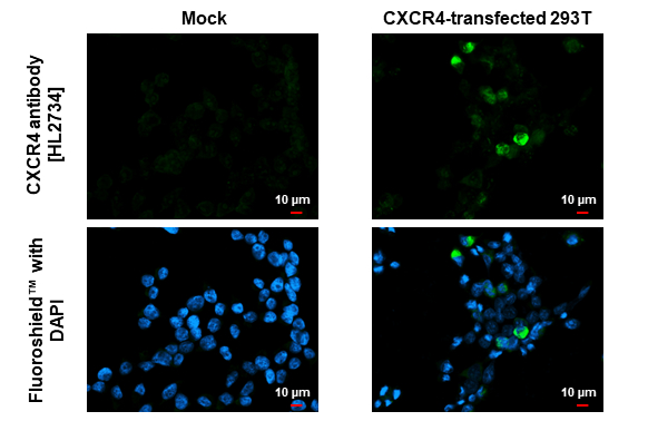 【25％OFF】 Anti-CXCR4 antibody [HL2734] (GTX639562) | GeneTex その他