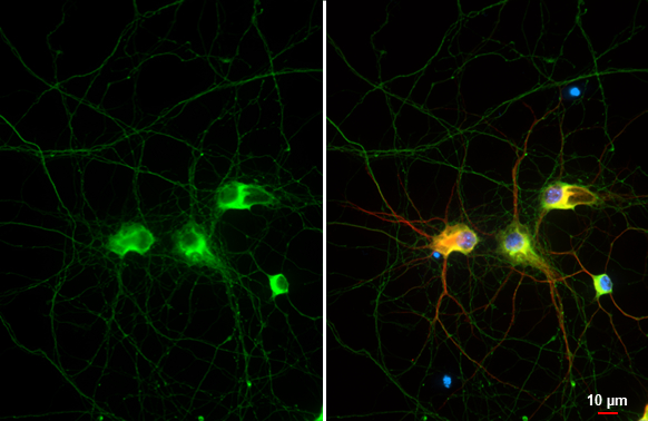 Anti-Tau antibody [HL2736] (GTX639564) | GeneTex