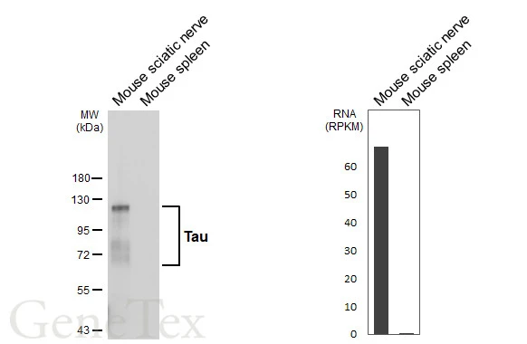 Anti-Tau antibody [HL2736] (GTX639564) | GeneTex