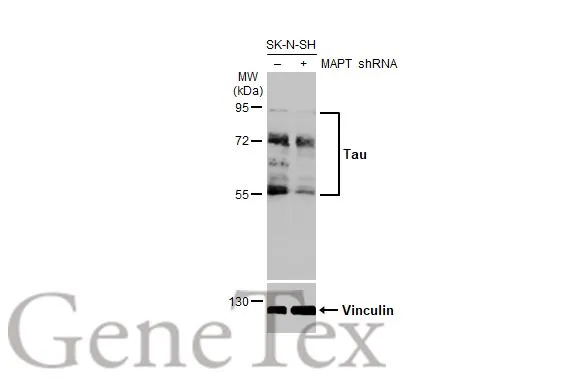 Anti-Tau antibody [HL2736] (GTX639564) | GeneTex