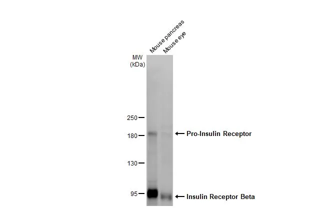 Various tissue extracts (50 μg) were separated by 5% SDS-PAGE, and the membrane was blotted with Insulin Receptor Beta antibody [HL2737] (GTX639566) diluted at 1:1000. The HRP-conjugated anti-rabbit IgG antibody (GTX213110-01) was used to detect the primary antibody, and the signal was developed with Trident femto Western HRP Substrate.