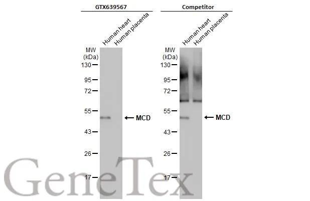 Various tissue extracts (5 μg) were separated by 10% SDS-PAGE, and the membranes were blotted with MCD antibody [HL2738] (GTX639567) diluted at 1:1000 and competitor's antibody (Competitor) diluted at 1:1000. The HRP-conjugated anti-rabbit IgG antibody (GTX213110-01) was used to detect the primary antibody. *The competitor is not affiliated with GeneTex and does not endorse this product.