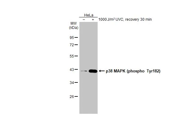 Untreated (–) and treated (+) HeLa whole cell extracts (30 μg) were separated by 10% SDS-PAGE, and the membrane was blotted with p38 MAPK (phospho Tyr182) antibody [HL2740] (GTX639569) diluted at 1:1000. The HRP-conjugated anti-rabbit IgG antibody (GTX213110-01) was used to detect the primary antibody.
