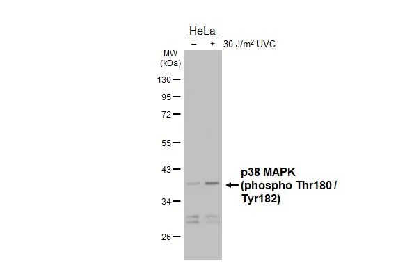 Untreated (–) and treated (+) HeLa whole cell extracts (50 μg) were separated by 10% SDS-PAGE, and the membrane was blotted with p38 MAPK (phospho Tyr182) antibody [HL2741] (GTX639570) diluted at 1:1000. The HRP-conjugated anti-rabbit IgG antibody (GTX213110-01) was used to detect the primary antibody.