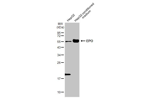 EPO antibody [HL2752]