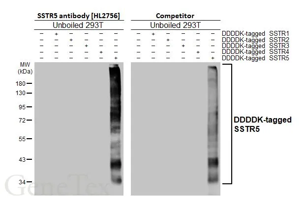Non-transfected (–) and transfected (+) unboiled 293T whole cell extracts were separated by 10% SDS-PAGE, and the membranes were blotted with SSTR5 antibody [HL2756] (GTX639619) diluted at 1:5000 and competitor's antibody diluted at 1:5000. The HRP-conjugated anti-rabbit IgG antibody (GTX213110-01) was used to detect the primary antibody. *The competitor is not affiliated with GeneTex and does not endorse this product.