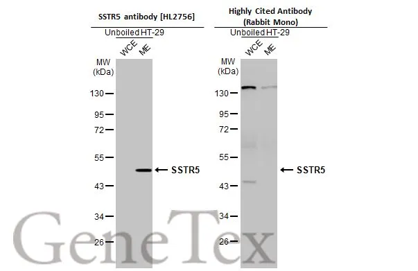 Unboiled HT-29 extracts (30 μg) were separated by 10% SDS-PAGE, and the membranes were blotted with SSTR5 antibody [HL2756] (GTX639619) diluted at 1:1000 and competitor's antibody (Competitor) diluted at 1:1000. The HRP-conjugated anti-rabbit IgG antibody (GTX213110-01) was used to detect the primary antibody. (WCE: whole cell extract; ME: membrane extract) *The competitor is not affiliated with GeneTex and does not endorse this product.