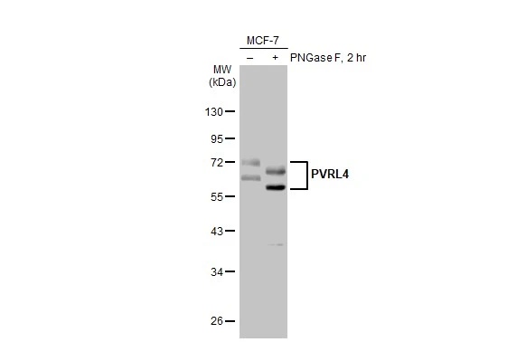 Untreated (–) and treated (+) MCF-7 whole cell extracts (30 μg) were separated by 10% SDS-PAGE, and the membrane was blotted with PVRL4 antibody [HL2758] (GTX639621) diluted at 1:1000. The HRP-conjugated anti-rabbit IgG antibody (GTX213110-01) was used to detect the primary antibody.