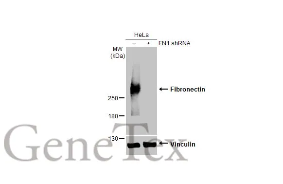 Fibronectin antibody [HL2761]