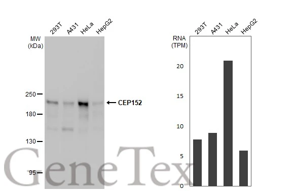 Various whole cell extracts (30 μg) were separated by 5% SDS-PAGE, and the membrane was blotted with CEP152 antibody [HL2763] (GTX639628) diluted at 1:1000. The HRP-conjugated anti-rabbit IgG antibody (GTX213110-01) was used to detect the primary antibody, and the signal was developed with Trident ECL plus-Enhanced. Corresponding RNA expression data for the same cell lines are based on Human Protein Atlas program.