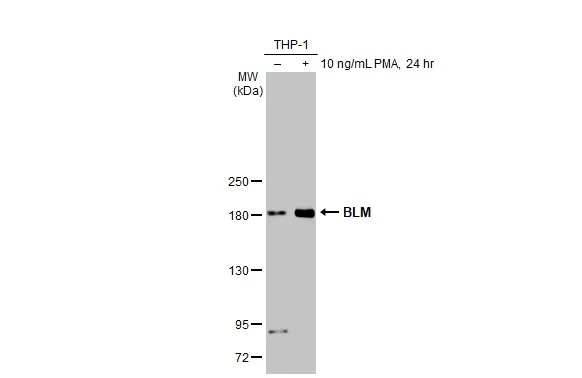 Untreated (–) and treated (+) THP-1 whole cell extracts (30 μg) were separated by 5% SDS-PAGE, and the membrane was blotted with BLM antibody [HL2771] (GTX639636) diluted at 1:1000. The HRP-conjugated anti-rabbit IgG antibody (GTX213110-01) was used to detect the primary antibody.