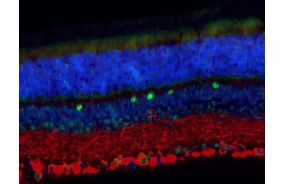 LIM1 antibody detects LIM1 protein at nucleus by immunohistochemical analysis. Sample: Paraffin-embedded mouse eye. Green: LIM1 stained by LIM1 antibody (GTX639639) diluted at 1:100. Red: beta Tubulin 3/ Tuj1, a neural marker, stained by beta Tubulin 3/ Tuj1 antibody [GT11710] (GTX631836) diluted at 1:500. Blue: Hoechst 33342 staining. Antigen Retrieval: Citrate buffer, pH 6.0, 15 min