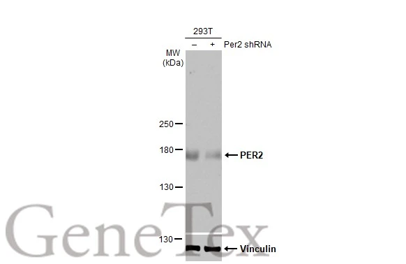 Non-transfected (–) and transfected (+) 293T whole cell extracts (30 μg) were separated by 5% SDS-PAGE, and the membrane was blotted with PER2 antibody [HL2775] (GTX639640) diluted at 1:1000. The HRP-conjugated anti-rabbit IgG antibody (GTX213110-01) was used to detect the primary antibody, and the signal was developed with Trident ECL plus-Enhanced.