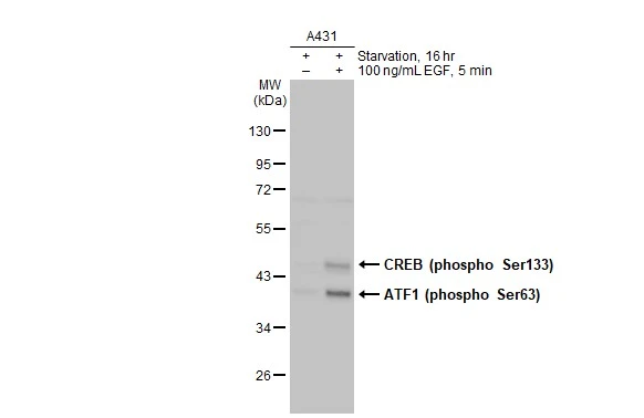 Untreated (–) and treated (+) A431 whole cell extracts (30 μg) were separated by 10% SDS-PAGE, and the membrane was blotted with CREB (phospho Ser133) antibody [HL2776] (GTX639641) diluted at 1:1000. The HRP-conjugated anti-rabbit IgG antibody (GTX213110-01) was used to detect the primary antibody.
