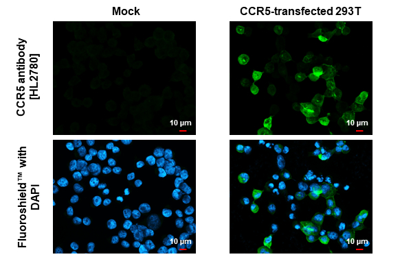 CCR5 antibody [HL2780] detects CCR5 protein by immunofluorescent analysis. Sample: Mock and transfected 293T cells were fixed in ice-cold MeOH for 5 min. Green: CCR5 stained by CCR5 antibody [HL2780] (GTX639645) diluted at 1:500. Blue: Fluoroshield with DAPI (GTX30920).