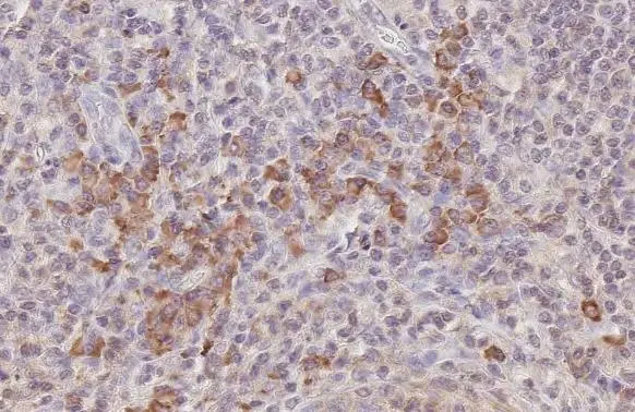 CCR5 antibody [HL2780]